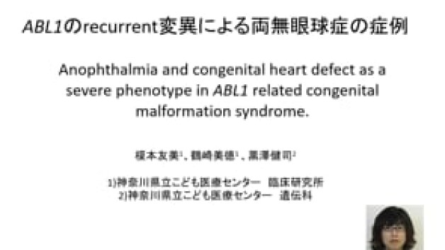 【O-41】ABL1のrecurrent変異による両無眼球症の症例